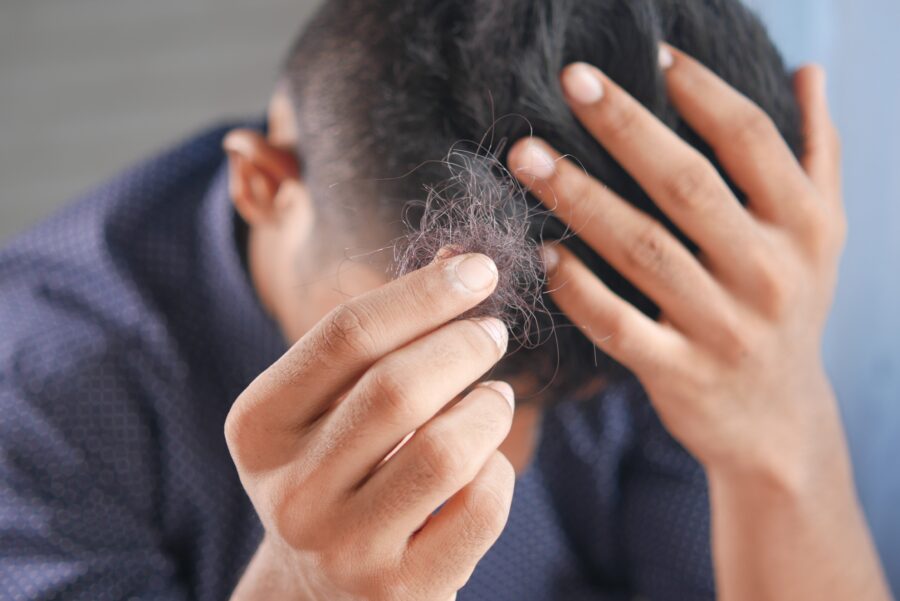 Vypadané kolečko vlasů: jaký je důvod lysého místa na vaší hlavě?