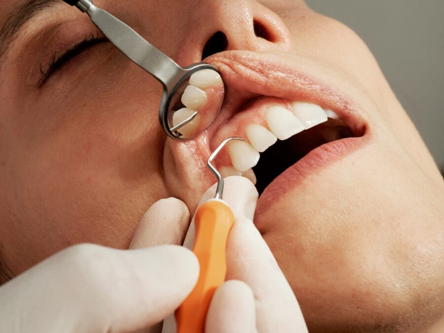 Ve 30 nemám zuby: nejčastější příčina, které se znažte vyhnout